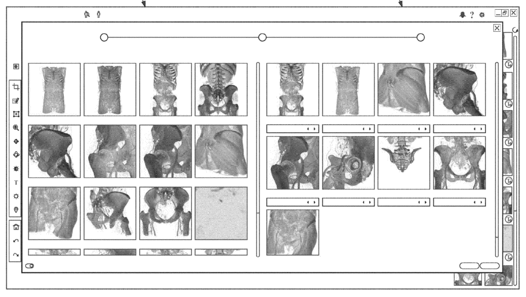 Illustration of User interface of system with medical images from digital health system